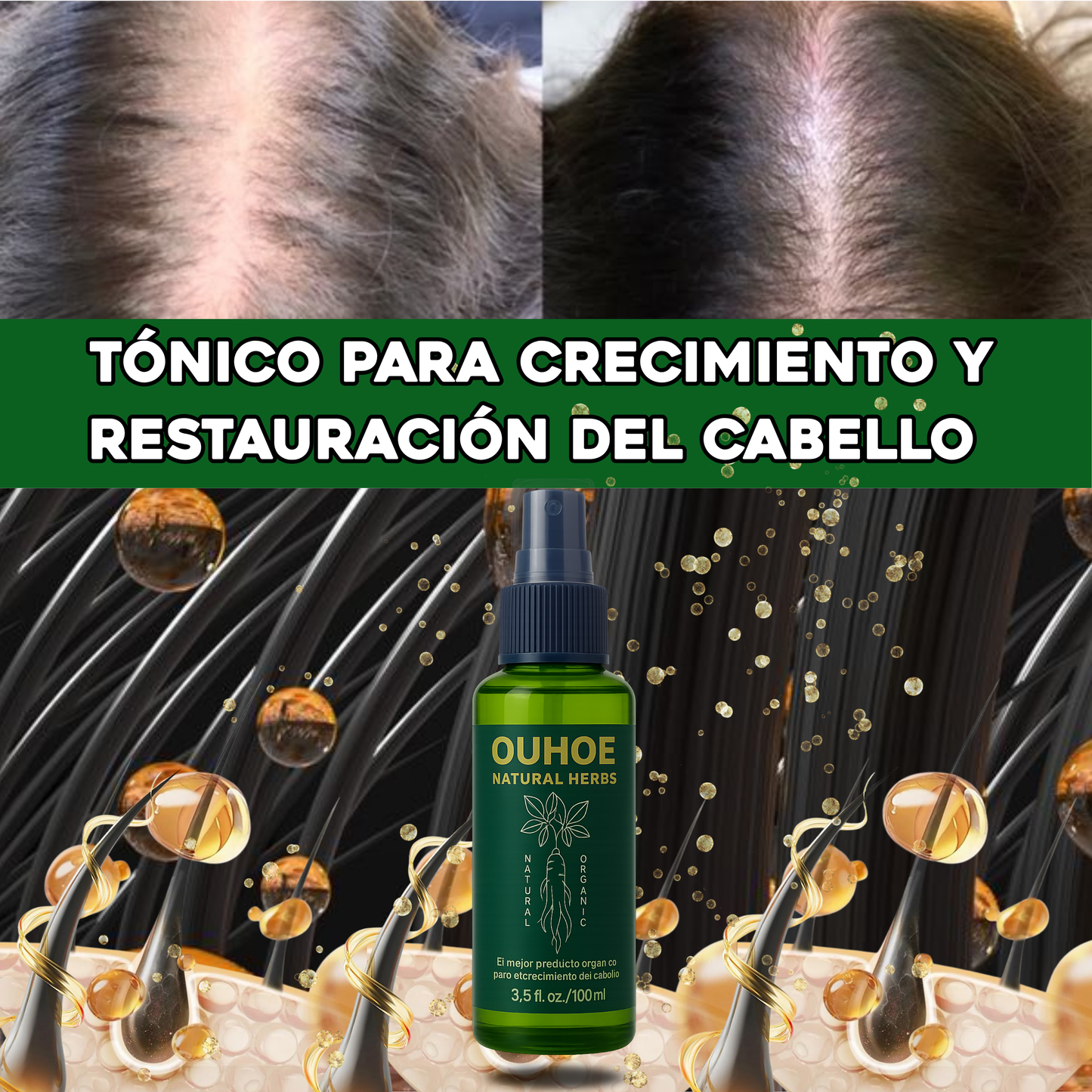 OUHOE POTENCIADOR DE CRECIMIENTO DE CABELLO ⭐⭐⭐⭐⭐