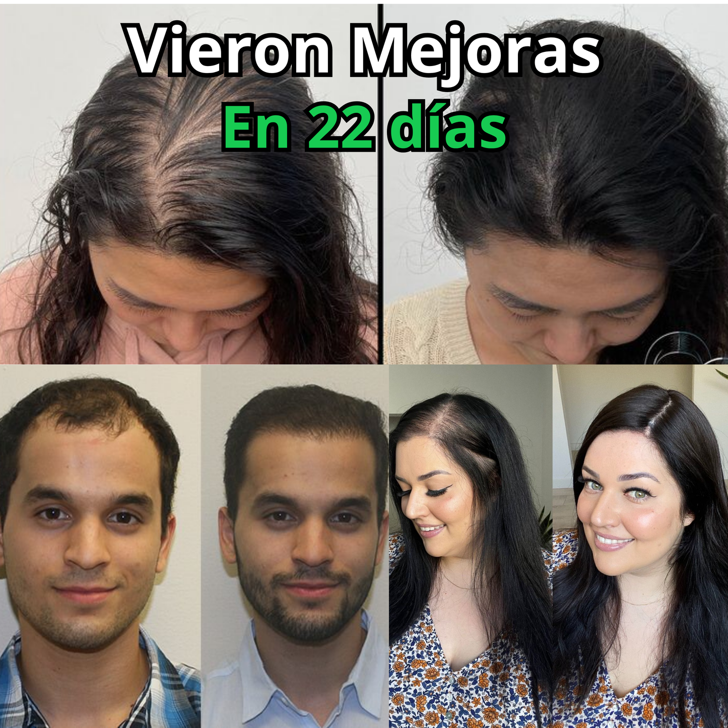 OUHOE POTENCIADOR DE CRECIMIENTO DE CABELLO ⭐⭐⭐⭐⭐
